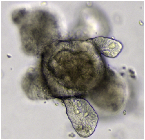 Microscopy image of an intestinal organoid grown in research